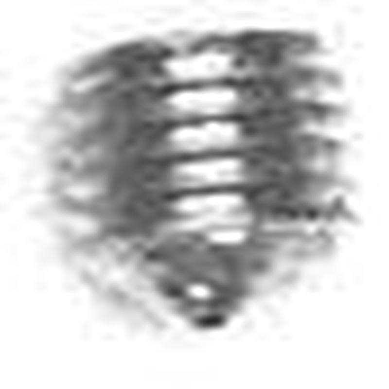 4mm Nickel,1.5m Allen Wrench Set Screw, Steel-PK10